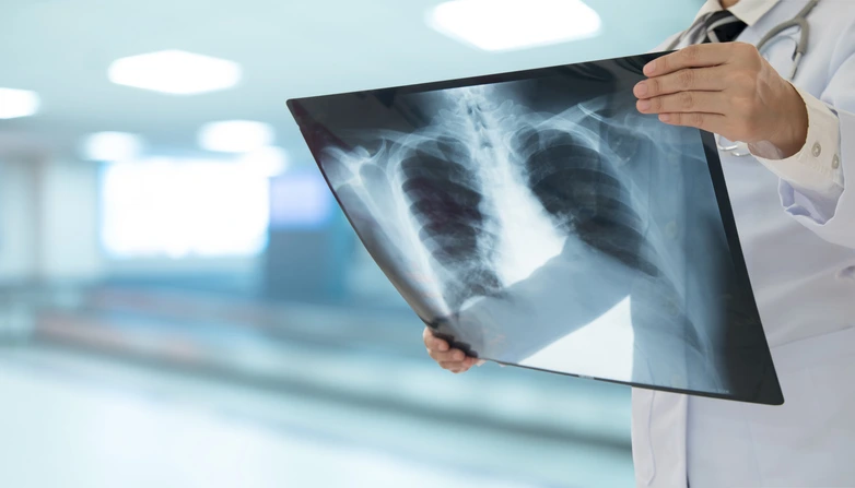Doctor holding an X-ray before secure medical shredding and destruction by DGD Shredding & Technology in Ireland